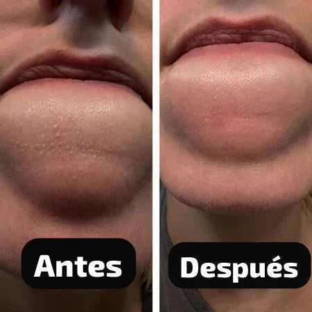 Dr. Melaxin® - Peel Shot Duo Kit