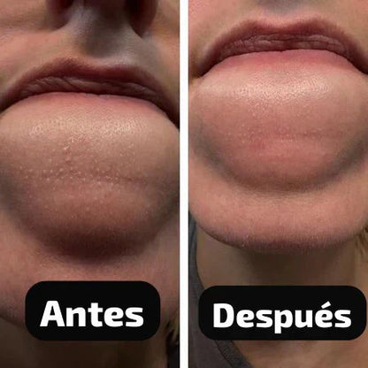 Dr. Melaxin® - Peel Shot Duo Kit